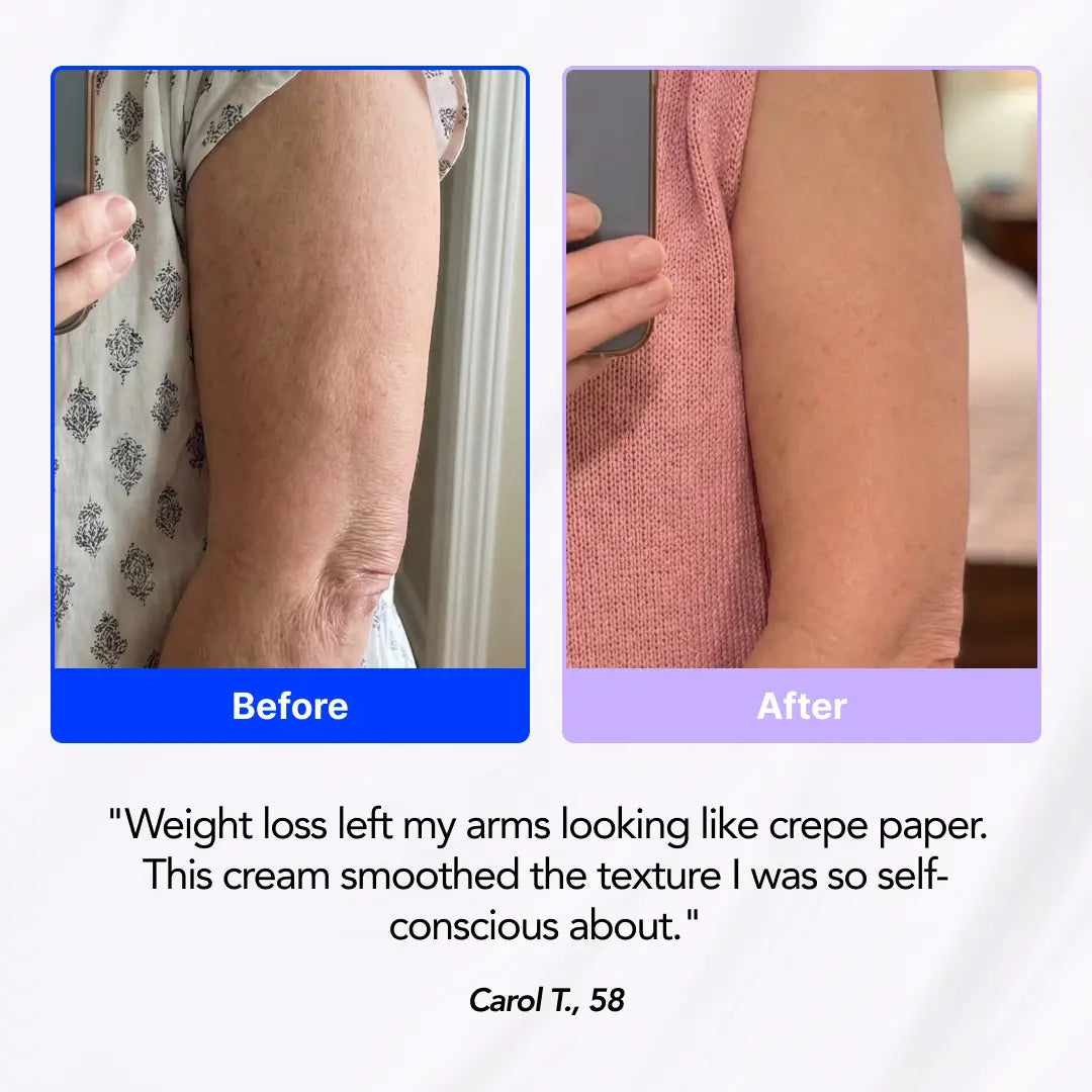 Arm Firming Cream