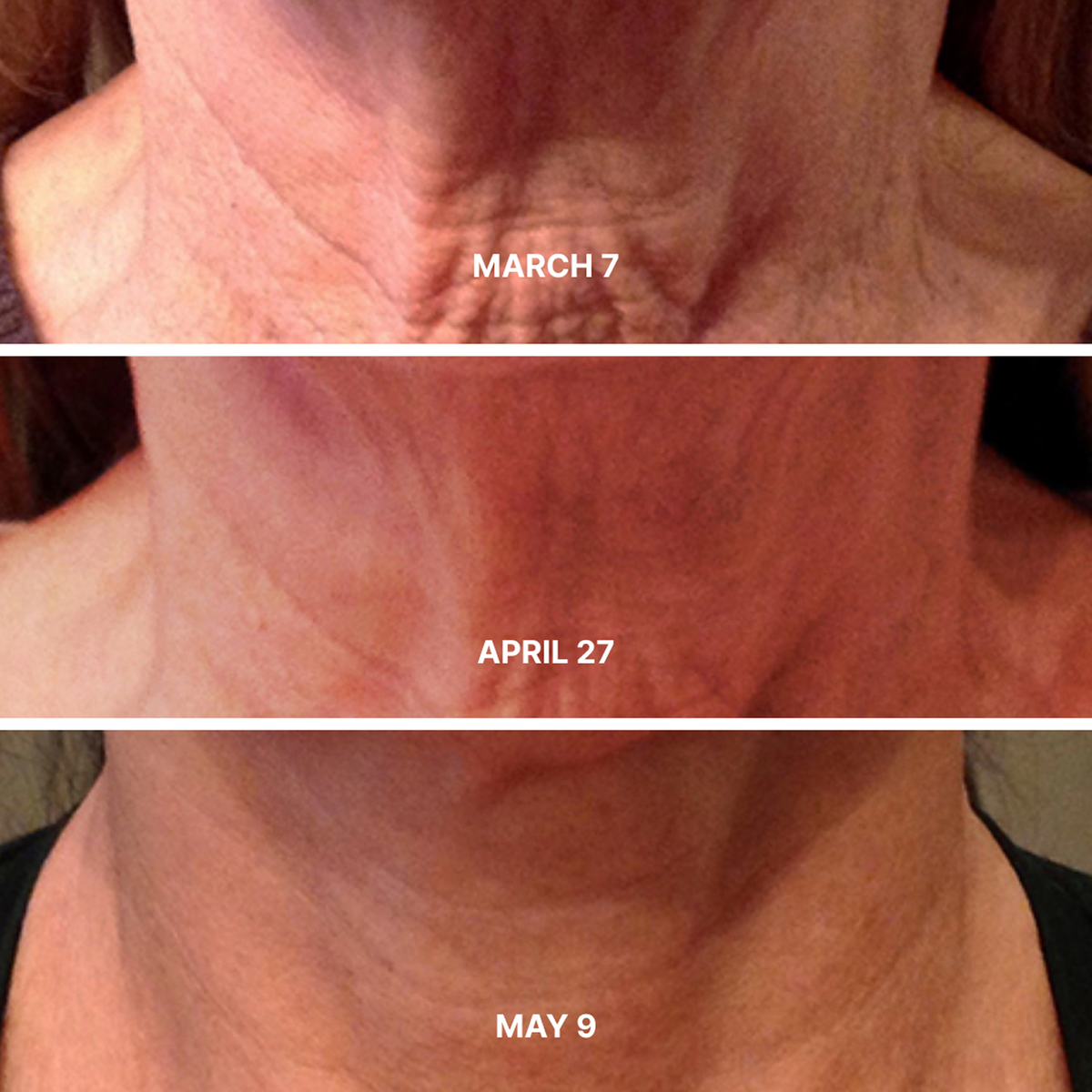 Neck Firming Cream (CC)