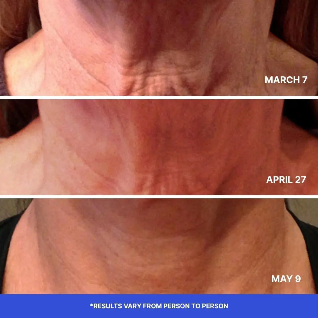 Neck Firming Cream