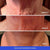 Neck Firming Cream