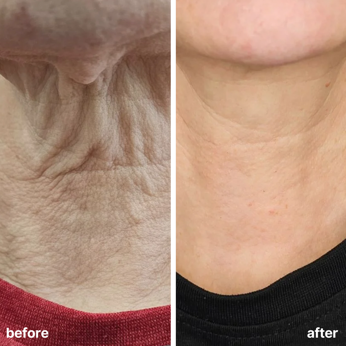 Neck Firming Cream (CC)